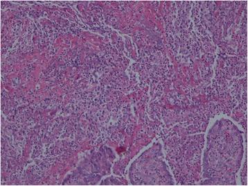 https://cdn.ncbi.nlm.nih.gov/pmc/blobs/2c1c/5806353/92951ff30431/12879_2018_2986_Fig4_HTML.jpg