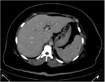 https://cdn.ncbi.nlm.nih.gov/pmc/blobs/2c1c/5806353/a0420fb191eb/12879_2018_2986_Fig2_HTML.jpg