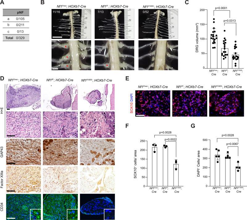 https://cdn.ncbi.nlm.nih.gov/pmc/blobs/2c23/9120229/c14d85bfb9dd/41467_2022_30466_Fig4_HTML.jpg