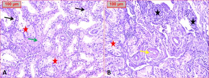 https://cdn.ncbi.nlm.nih.gov/pmc/blobs/2c26/12181436/44d6fc50ef11/41598_2025_6263_Fig10_HTML.jpg