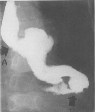 https://cdn.ncbi.nlm.nih.gov/pmc/blobs/2c26/1450493/7bb3a7084aa3/annsurg01231-0030-a.jpg