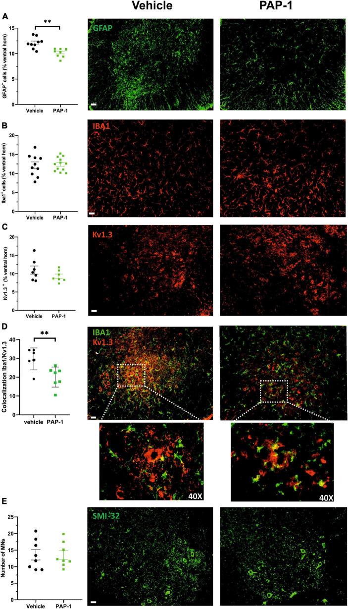 https://cdn.ncbi.nlm.nih.gov/pmc/blobs/2c27/10824952/d7a949065bb6/fnmol-16-1333745-g004.jpg