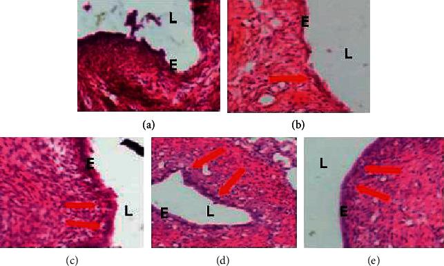 https://cdn.ncbi.nlm.nih.gov/pmc/blobs/2c27/7397419/66ea916f09e1/ECAM2020-8521831.004.jpg