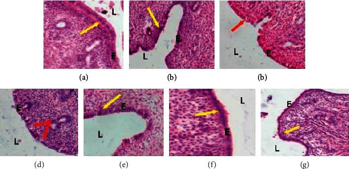 https://cdn.ncbi.nlm.nih.gov/pmc/blobs/2c27/7397419/6b7df9a84691/ECAM2020-8521831.003.jpg
