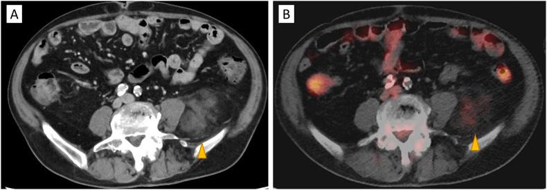 https://cdn.ncbi.nlm.nih.gov/pmc/blobs/2c3c/10468332/89afcca049ff/gr1.jpg