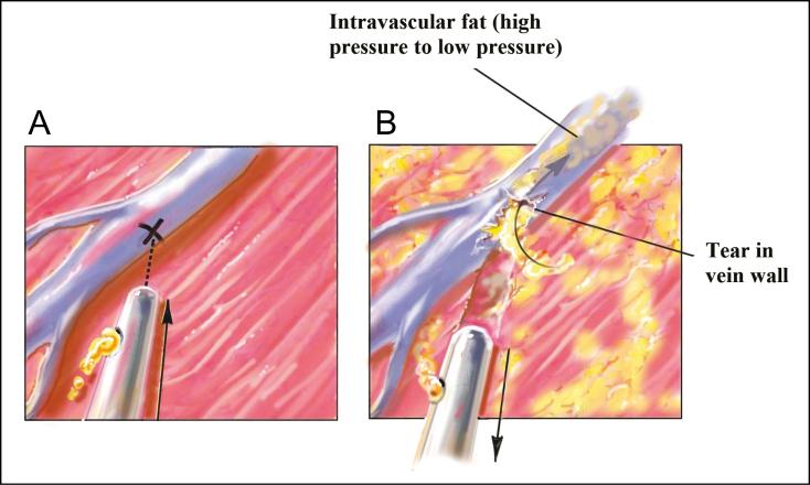 https://cdn.ncbi.nlm.nih.gov/pmc/blobs/2c4b/5846701/2ca30c7eb7fb/sjx00402.jpg