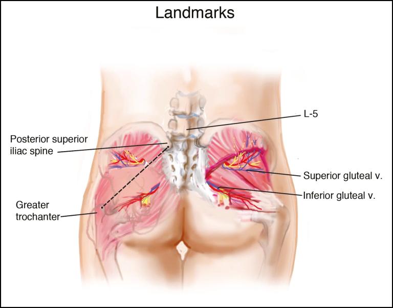 https://cdn.ncbi.nlm.nih.gov/pmc/blobs/2c4b/5846701/d1a27e2184ad/sjx00405.jpg