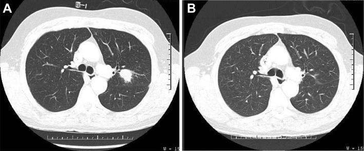 https://cdn.ncbi.nlm.nih.gov/pmc/blobs/2c57/5634777/21428e4d865d/onco12213-fig-0002.jpg
