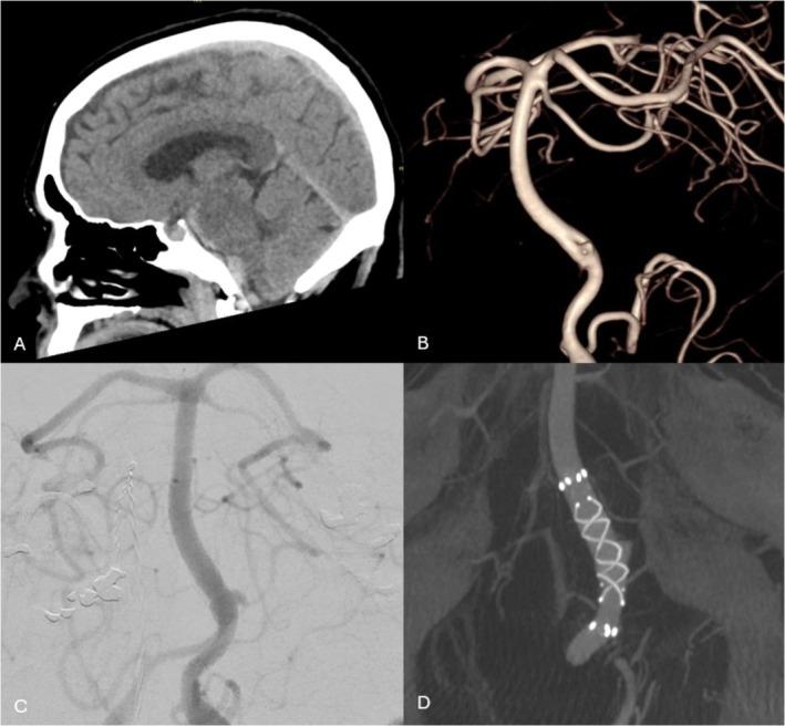 https://cdn.ncbi.nlm.nih.gov/pmc/blobs/2c5d/12175205/f0e67c3534ee/ARA-69-484-g002.jpg