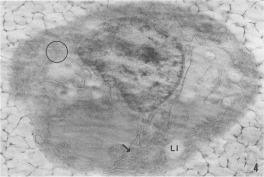 https://cdn.ncbi.nlm.nih.gov/pmc/blobs/2c5f/1887893/332d770503d2/amjpathol00170-0039-b.jpg