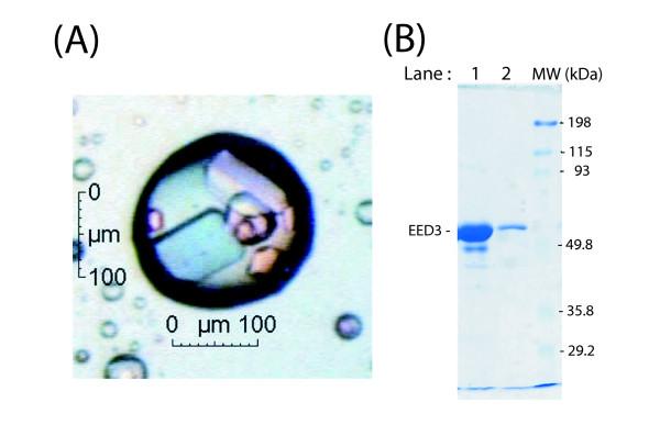https://cdn.ncbi.nlm.nih.gov/pmc/blobs/2c64/2292171/ee3a2cfaa539/1743-422X-5-32-1.jpg