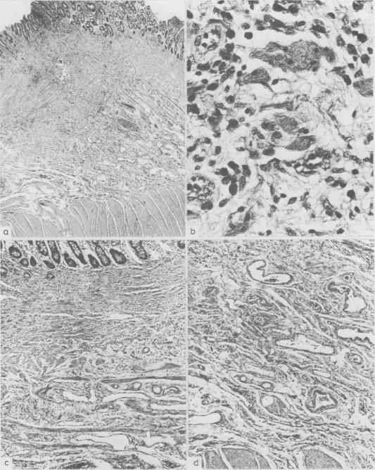 https://cdn.ncbi.nlm.nih.gov/pmc/blobs/2c66/1419810/b7d1d89cb8c7/gut00420-0108-a.jpg