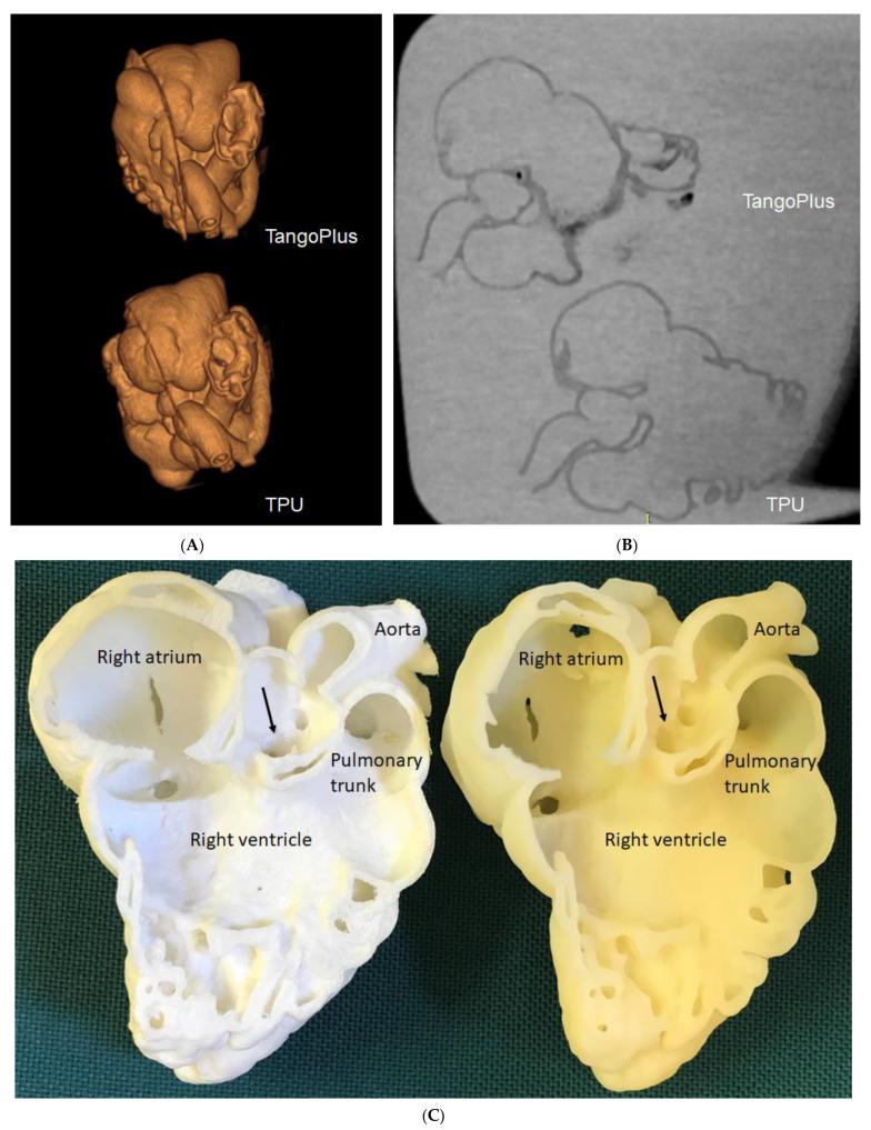 https://cdn.ncbi.nlm.nih.gov/pmc/blobs/2c66/9955978/1355b9ae0b7e/children-10-00319-g005.jpg