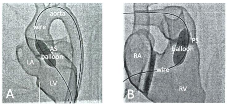 https://cdn.ncbi.nlm.nih.gov/pmc/blobs/2c66/9955978/eb2bf789b78a/children-10-00319-g012.jpg