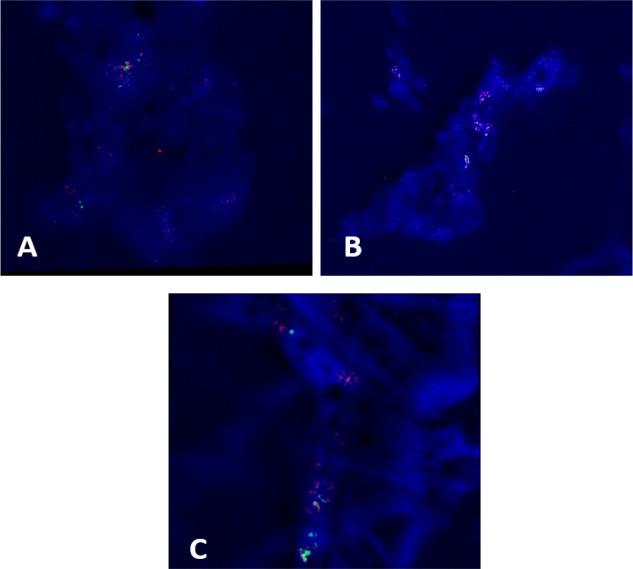 https://cdn.ncbi.nlm.nih.gov/pmc/blobs/2c68/11382861/f335ce55a7d4/APJCP-25-2023-g002.jpg