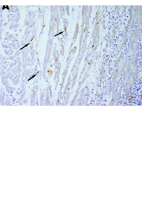 https://cdn.ncbi.nlm.nih.gov/pmc/blobs/2c69/3294714/6f72d9d65599/05-1614-F4.jpg