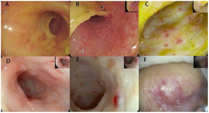 https://cdn.ncbi.nlm.nih.gov/pmc/blobs/2c6c/7943473/2c60acd12cd2/fped-09-545771-g0002.jpg