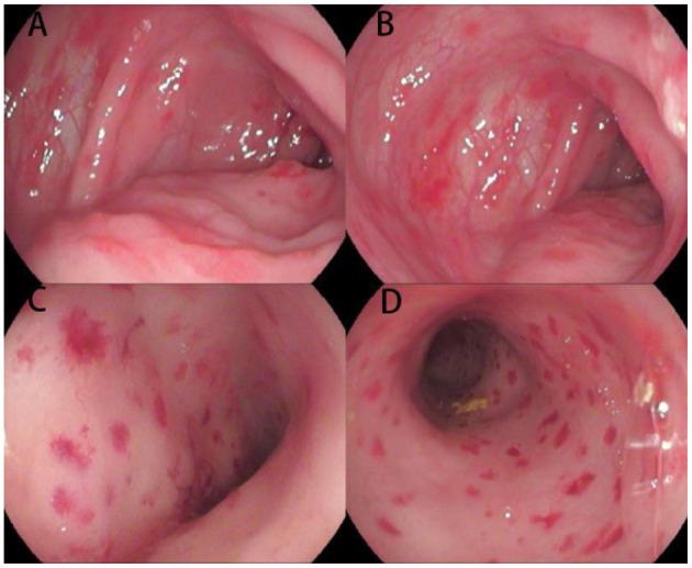 https://cdn.ncbi.nlm.nih.gov/pmc/blobs/2c6c/7943473/648ada8eafd0/fped-09-545771-g0001.jpg