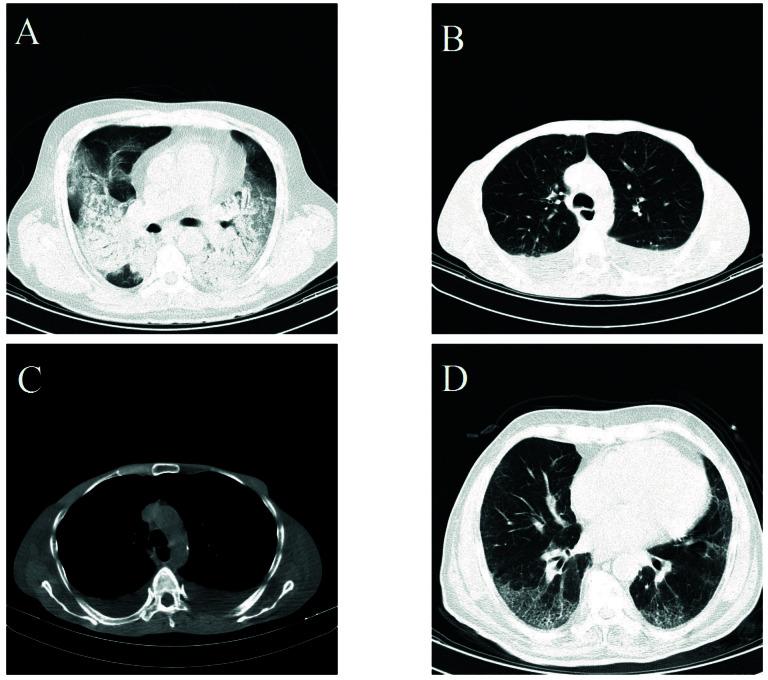 https://cdn.ncbi.nlm.nih.gov/pmc/blobs/2c77/8957696/389e765d9a05/jrhs-21-e00510-g001.jpg