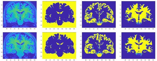 https://cdn.ncbi.nlm.nih.gov/pmc/blobs/2c79/6456669/8c52ddc9ab24/fneur-10-00291-g0002.jpg