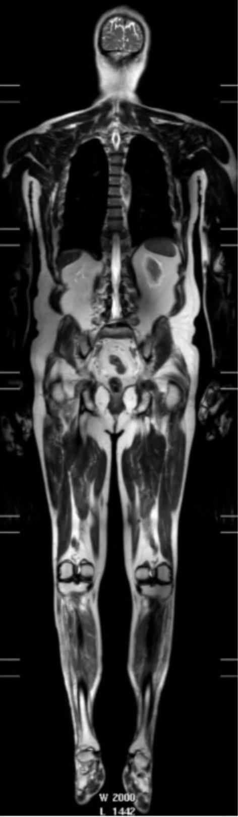https://cdn.ncbi.nlm.nih.gov/pmc/blobs/2c79/6456669/da02510cc12c/fneur-10-00291-g0004.jpg