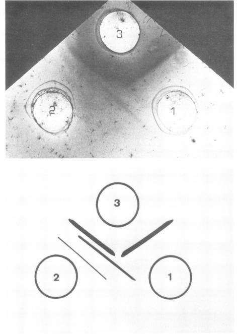 https://cdn.ncbi.nlm.nih.gov/pmc/blobs/2c7a/347884/45949444fc24/iai00147-0470-a.jpg