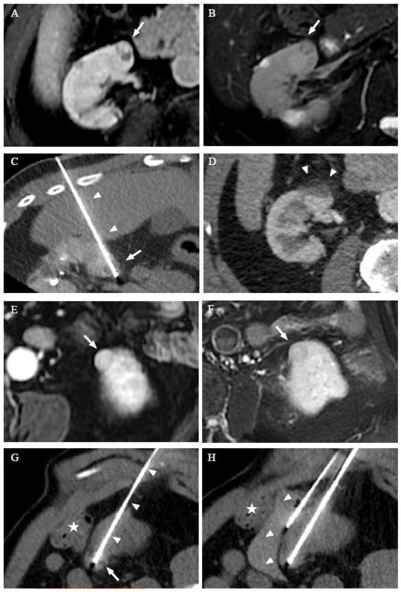 https://cdn.ncbi.nlm.nih.gov/pmc/blobs/2c7a/9599652/beb94fa03aad/cancers-14-04969-g001.jpg