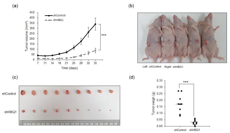 https://cdn.ncbi.nlm.nih.gov/pmc/blobs/2c7d/10705095/3db18a0d166b/cancers-15-05504-g004.jpg