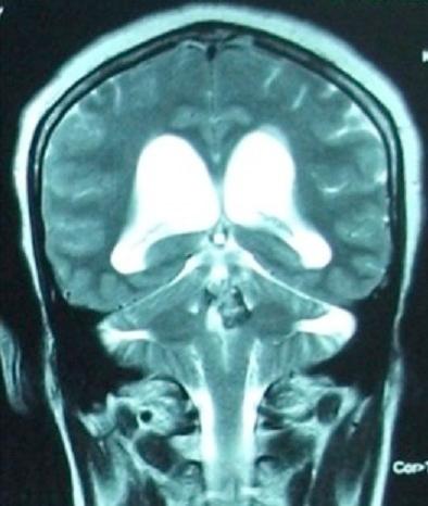 https://cdn.ncbi.nlm.nih.gov/pmc/blobs/2c7e/4250029/d485e473fd7c/PAMJ-18-331-g003.jpg