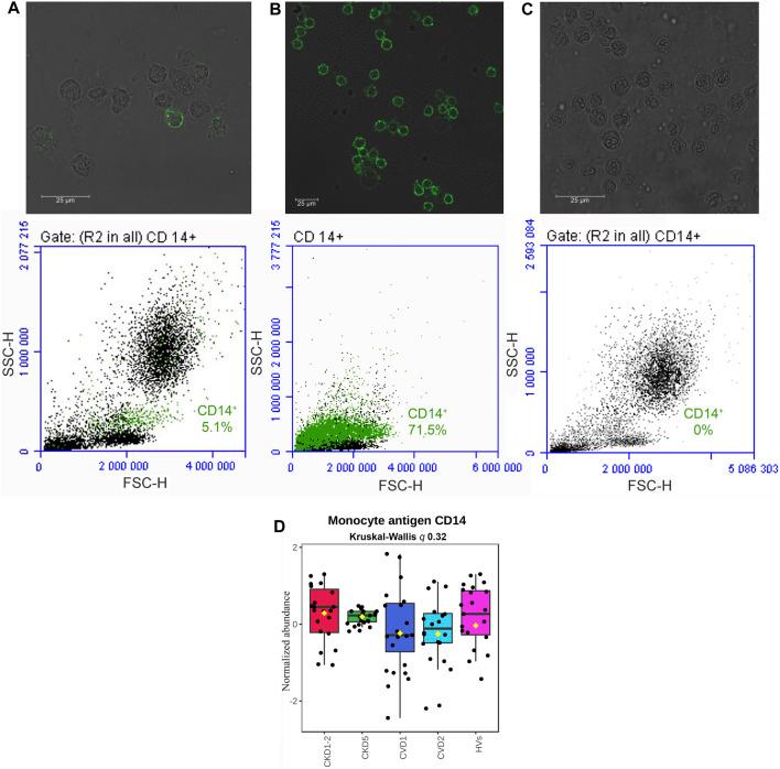 https://cdn.ncbi.nlm.nih.gov/pmc/blobs/2c81/10882078/de3ac1a05fc2/fmolb-11-1229648-g001.jpg