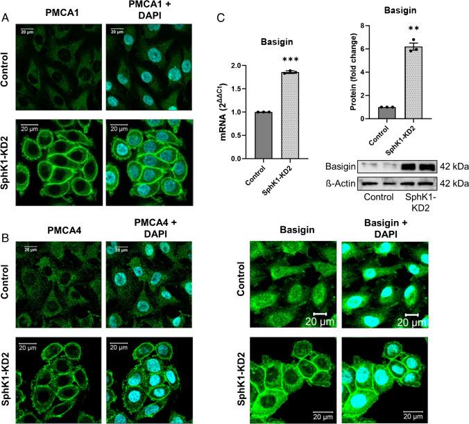 https://cdn.ncbi.nlm.nih.gov/pmc/blobs/2c82/11582158/cdc3827bbb6c/424_2024_3027_Fig4_HTML.jpg