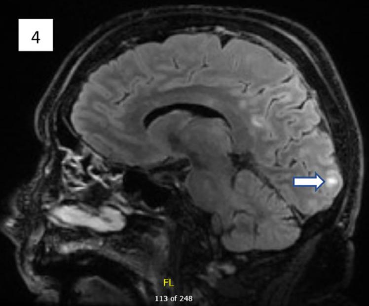 https://cdn.ncbi.nlm.nih.gov/pmc/blobs/2c86/7506375/946624056ec5/cro-0013-1013-g04.jpg