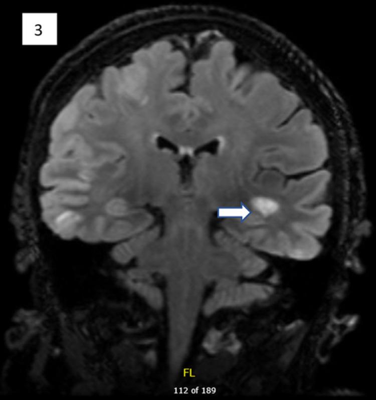 https://cdn.ncbi.nlm.nih.gov/pmc/blobs/2c86/7506375/a9f3a5a7de08/cro-0013-1013-g03.jpg