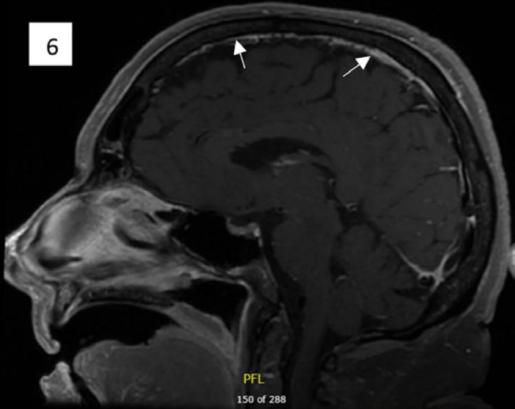 https://cdn.ncbi.nlm.nih.gov/pmc/blobs/2c86/7506375/b10be771b85c/cro-0013-1013-g06.jpg