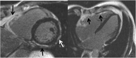 https://cdn.ncbi.nlm.nih.gov/pmc/blobs/2c8b/4222825/c5a6d8d597e4/s12968-014-0050-8-5.jpg