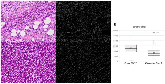https://cdn.ncbi.nlm.nih.gov/pmc/blobs/2c8f/10845137/8fcf523ffb65/fonc-14-1277749-g004.jpg
