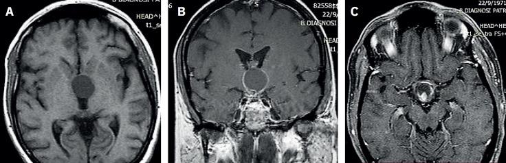 https://cdn.ncbi.nlm.nih.gov/pmc/blobs/2c92/10495134/6041a6632da7/MSM-35-162-g001.jpg
