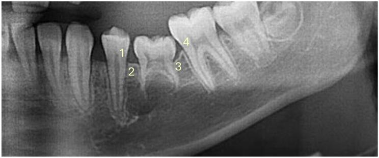 https://cdn.ncbi.nlm.nih.gov/pmc/blobs/2c97/11524026/01fcd291bb8f/13005_2024_469_Fig6_HTML.jpg