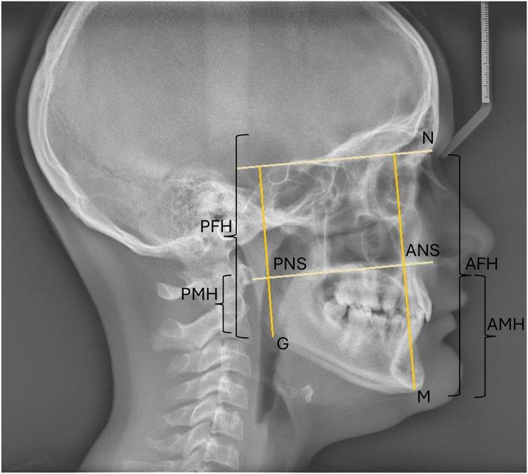 https://cdn.ncbi.nlm.nih.gov/pmc/blobs/2c97/11524026/ebe60cbac4bc/13005_2024_469_Fig8_HTML.jpg