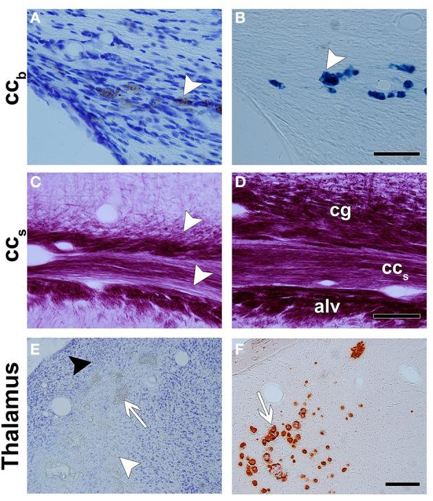 https://cdn.ncbi.nlm.nih.gov/pmc/blobs/2c99/4406060/ee4c865e5254/fnins-09-00128-g0003.jpg