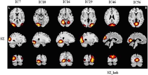 https://cdn.ncbi.nlm.nih.gov/pmc/blobs/2c9a/3257855/a7fa271c0ba7/fnsys-05-00103-a006.jpg