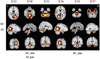 https://cdn.ncbi.nlm.nih.gov/pmc/blobs/2c9a/3257855/faa5b7f18b79/fnsys-05-00103-a001.jpg