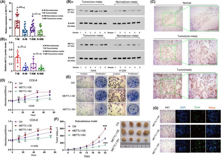 https://cdn.ncbi.nlm.nih.gov/pmc/blobs/2c9f/11225164/87c63b580c1a/CAM4-13-e7420-g004.jpg