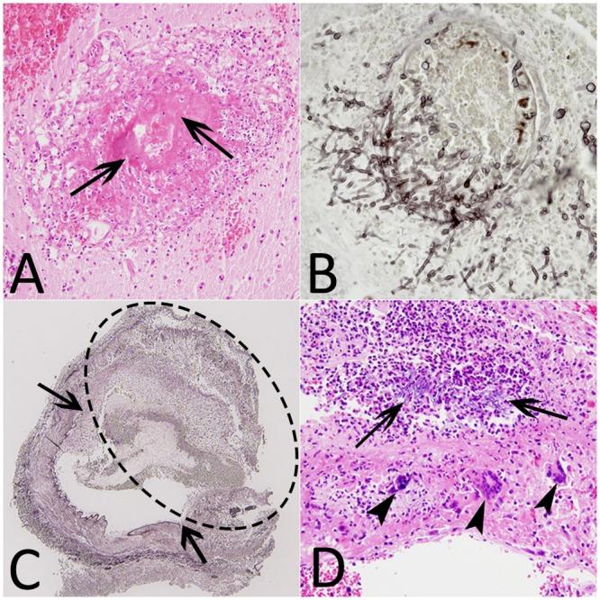 https://cdn.ncbi.nlm.nih.gov/pmc/blobs/2ca3/4838310/d1d546e6ea56/pone.0152475.g005.jpg