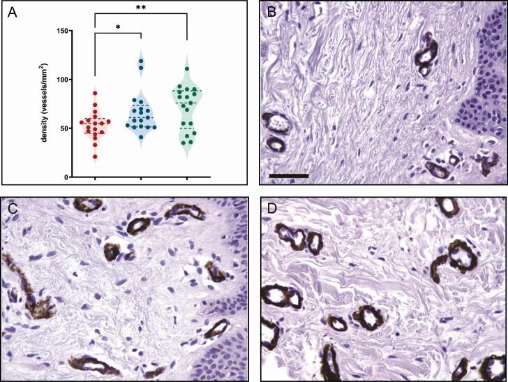 https://cdn.ncbi.nlm.nih.gov/pmc/blobs/2cb0/8922688/42771e0b500c/sjab280_fig4.jpg