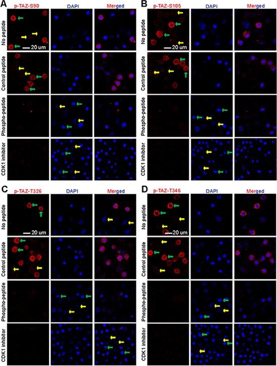 https://cdn.ncbi.nlm.nih.gov/pmc/blobs/2cba/4741614/0db41422568c/oncotarget-06-31399-g002.jpg