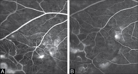 https://cdn.ncbi.nlm.nih.gov/pmc/blobs/2cc1/2841384/6aed6df0646f/IJO-58-80-g002.jpg