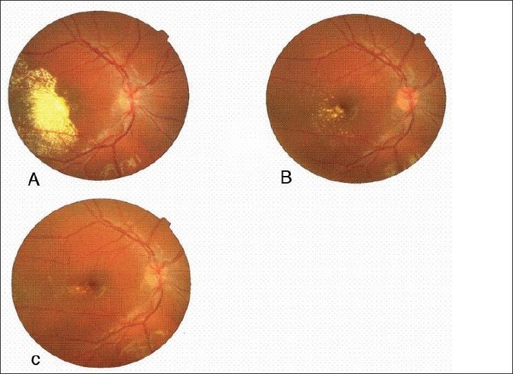 https://cdn.ncbi.nlm.nih.gov/pmc/blobs/2cc1/2841384/c10f2ba81579/IJO-58-80-g001.jpg
