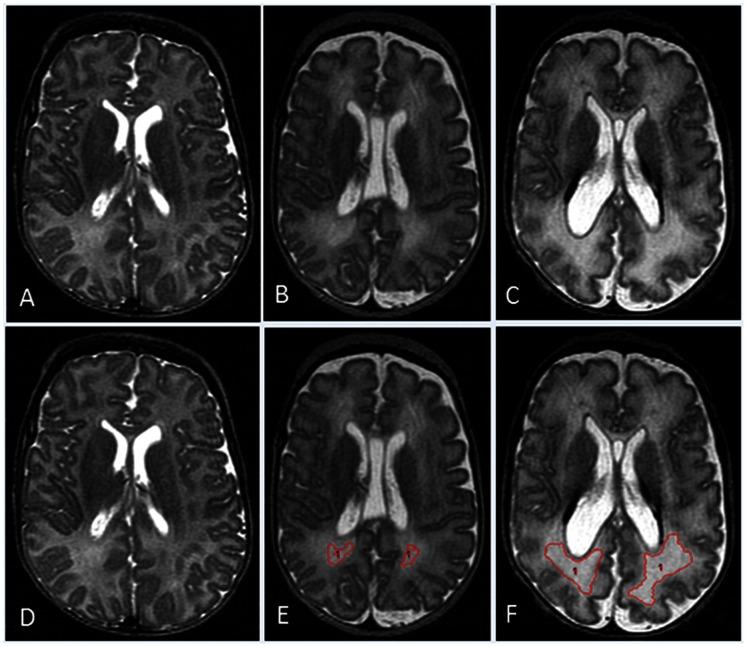 https://cdn.ncbi.nlm.nih.gov/pmc/blobs/2cc3/3650008/edb3be21cf63/pone.0062804.g001.jpg