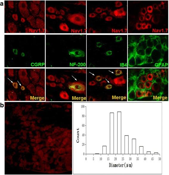 https://cdn.ncbi.nlm.nih.gov/pmc/blobs/2cc8/5678798/83d477cb77c6/12871_2017_438_Fig3_HTML.jpg